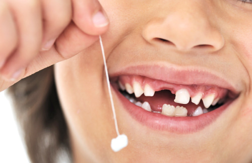 Как Удалить Зуб В Домашних Условиях?